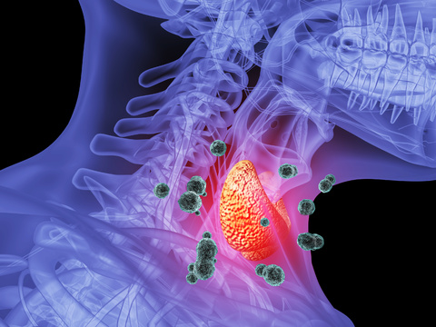 Human hyperthyroidism scene