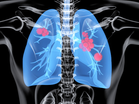 Modern human lungs