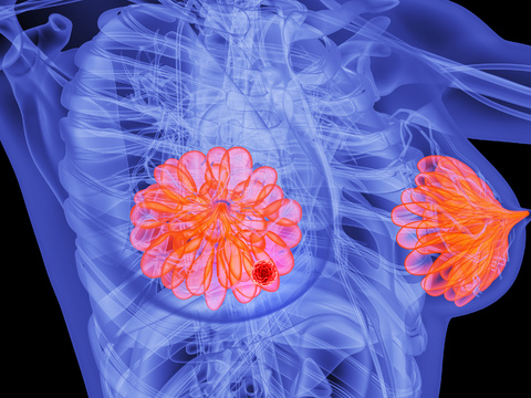 Human breast lesion scene