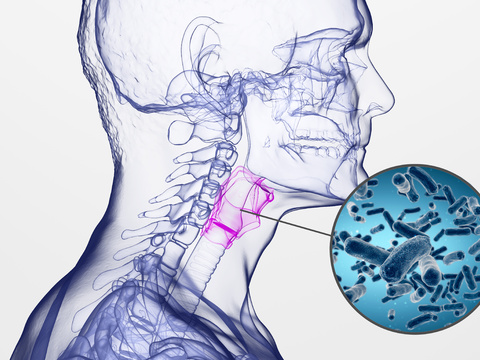 pharyngitis of human body