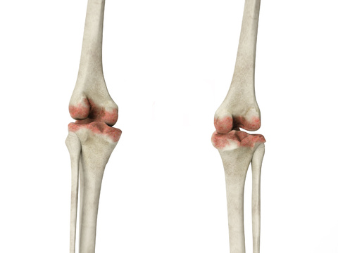 human joint