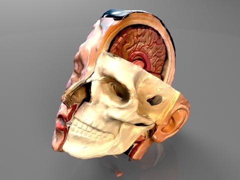 Medical Dies Brain Structure Head Structure