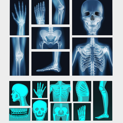 bone x-ray human body CT medical examination head hand leg joint bone